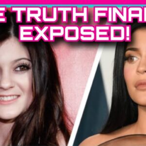 Kylie Jenner FINALLY ADMITS PLASTIC SURGERY!