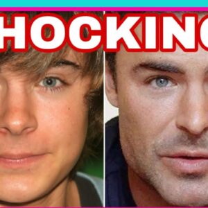 FANS SHOCKED WITH ZAC EFRON FACE?!!!